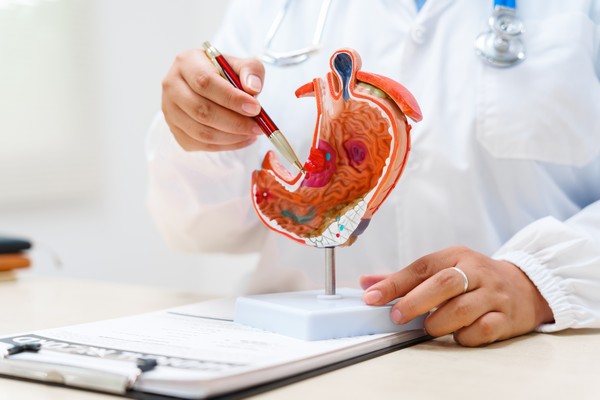 AstraZeneca amplía las alternativas de tratamiento para pacientes con cáncer gástrico